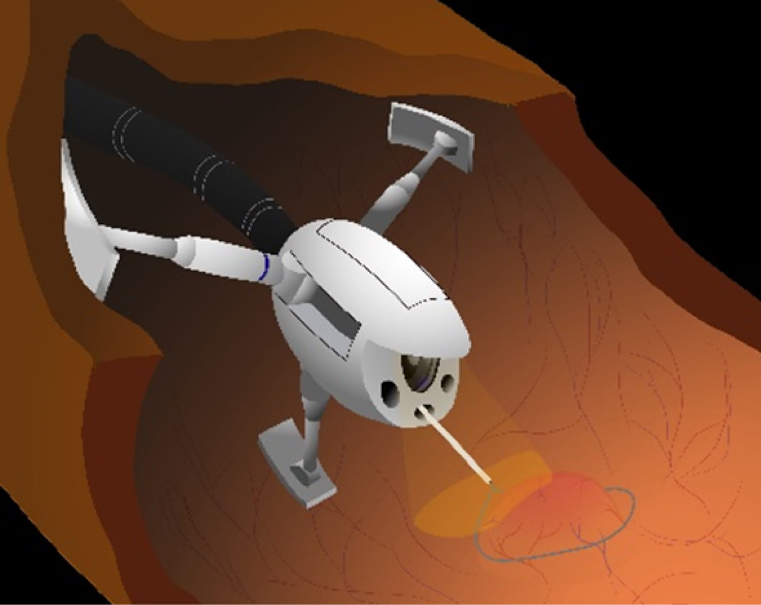 医療用ロボット
